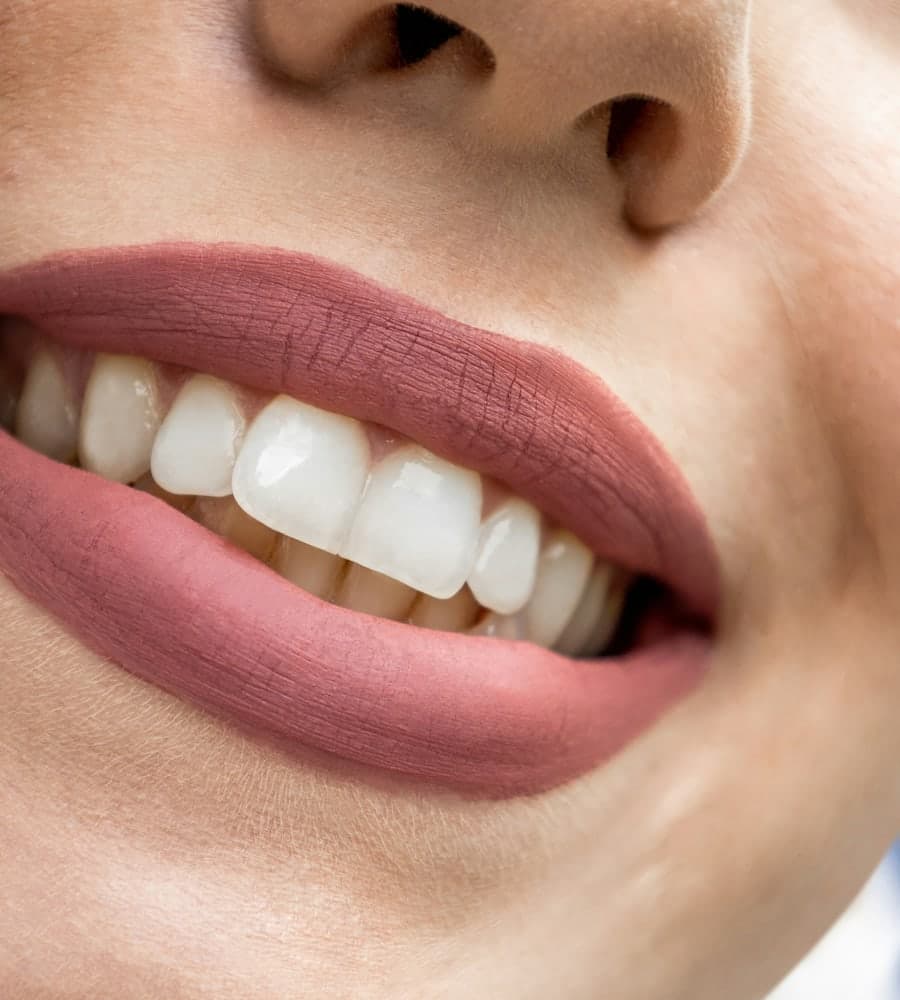 Teintier posé contre un sourire