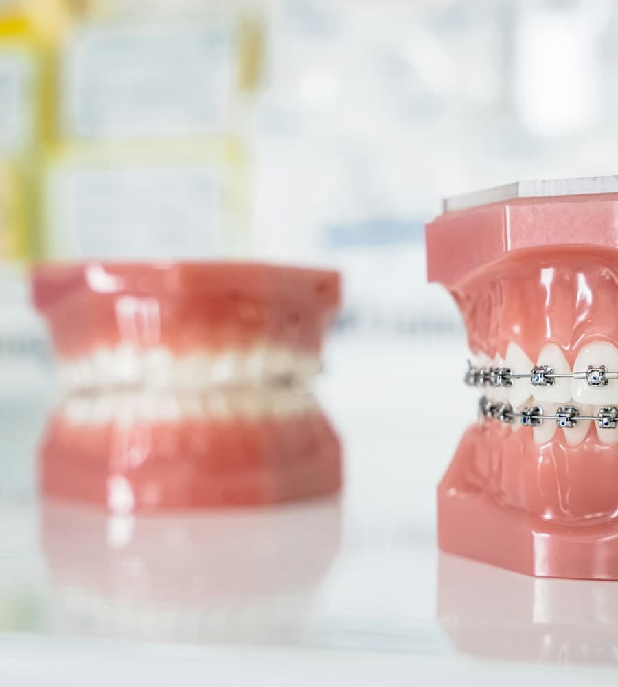 Traitement orthodontique